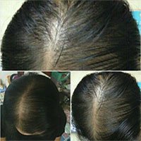 นีโอแฮร์ ของปลอม